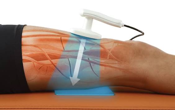 TECAR therapy applied to the knee